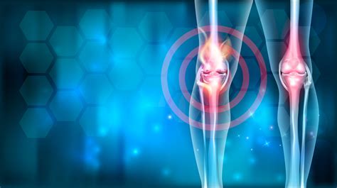 dezvoltarea artritei reumatoide stadiul inițial al artrozei deformante
